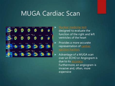 Cardiac Procedures