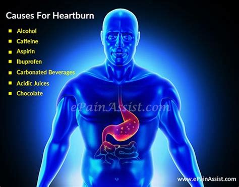 Treat Heartburn The Natural Way: Home Remedies & Prevention