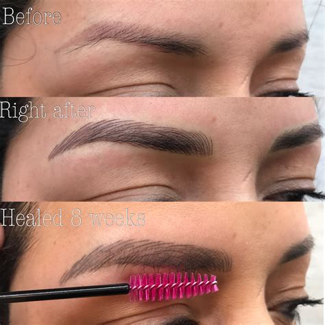 29+ Laser Eyebrow Tattoo Removal Before And After Pics | Eyebrow Ideas