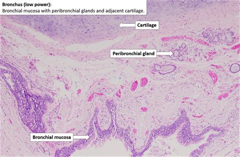 Bronchus Histology Labeled