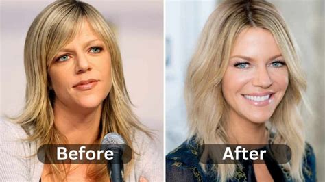 Kaitlin Olson Plastic Surgery, Before & After - Weight Loss