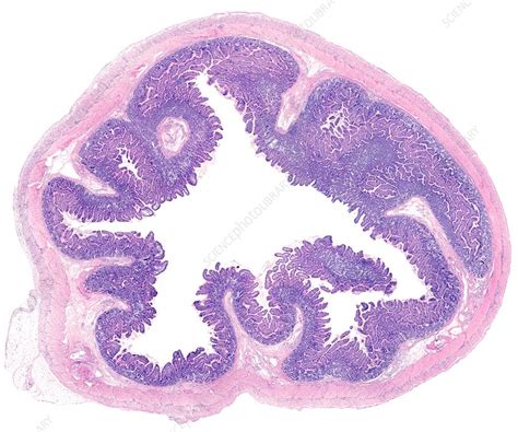 Ileum : Endoscopy Terminal Ileum Normal Finding Doccheck / The ileum ...