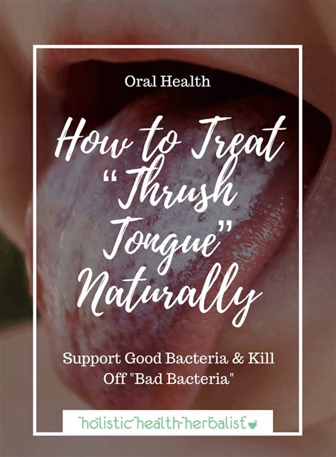 How to Treat “Thrush Tongue” Naturally - Holistic Health Herbalist