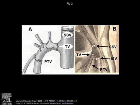 Alberto Caggiati, MD, PhD, John J - ppt download