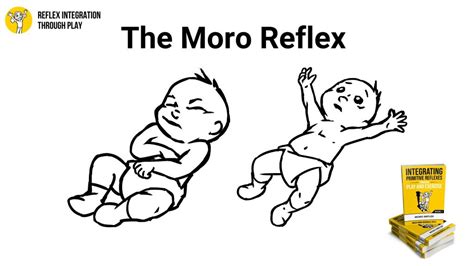 The Moro Reflex: Key to Infant Survival and Development - Reflex Integration Through Play