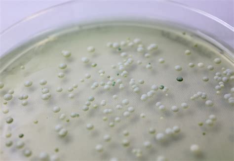 Sequencing Wild Yeast: Brewers Team Up with Scientists to Better Understand Fermentation ...