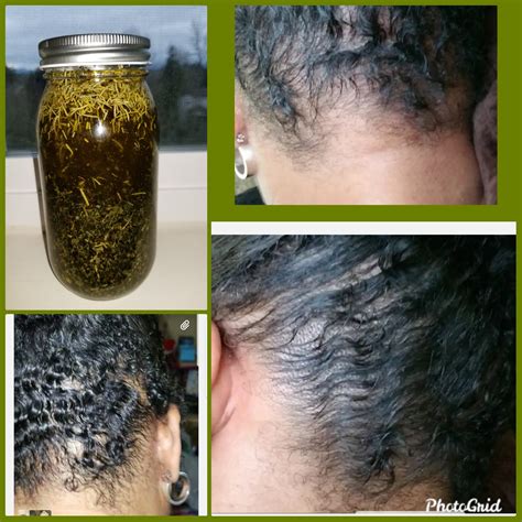 Organic Hair Growth Serum Hair Loss Serum Grow Long Hair - Etsy