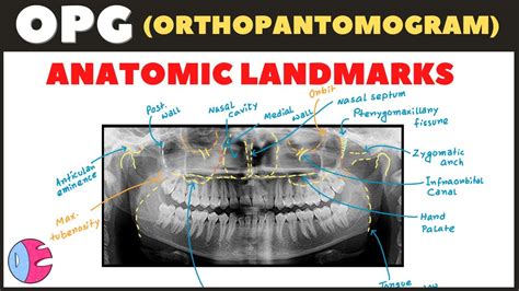 Anatomical Landmarks On Panoramic X Ray