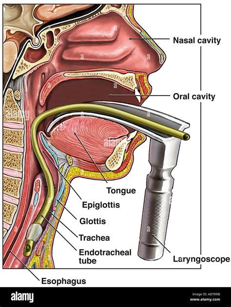 Intubation with Laryngoscope Stock Photo: 7710138 - Alamy