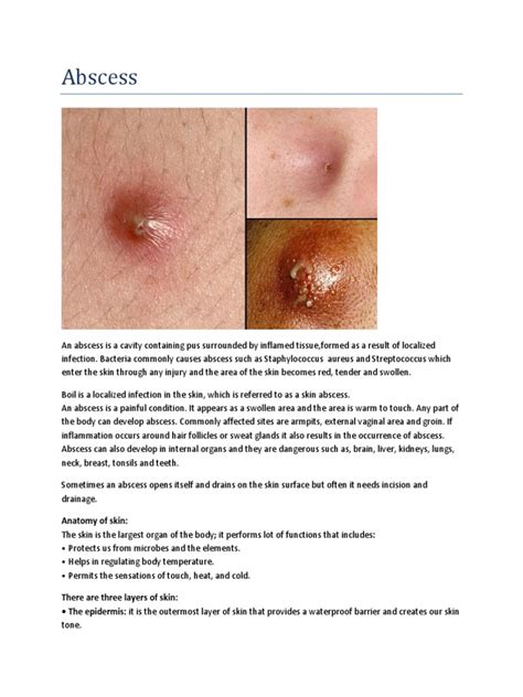 Abscess | Skin | Medical Specialties