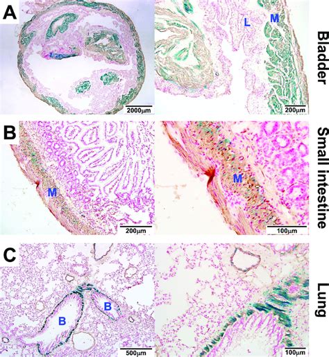 MYL9 is highly expressed in the muscularis propria of the bladder and ...