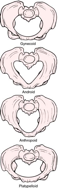 Android pelvis | definition of android pelvis by Medical dictionary