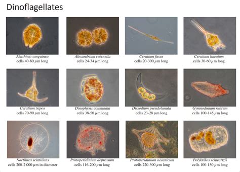 Dinoflagellates Under Microscope Labeled