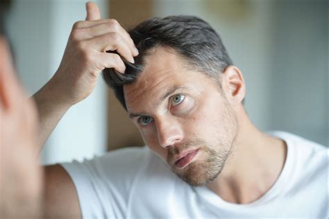 Hair Loss in Men due to Hormonal Imbalance | Healthgains