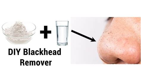 Home Remedies to Get Rid of Blackheads Fast | Top 10 Home Remedies