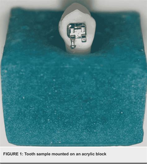 Figure 1 from Evaluation of Shear Bond Strength of a Primer Incorporated Orthodontic Composite ...