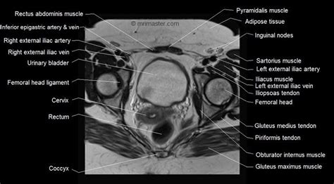 Pin on Pelvis anatomy