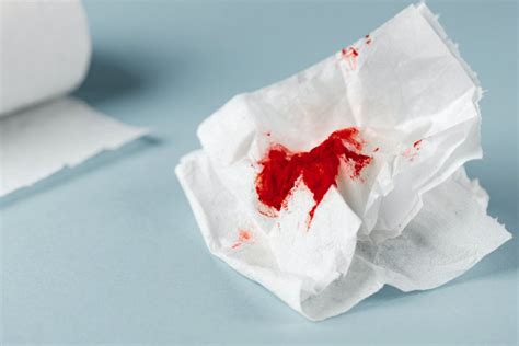 Hemorrhoids Bleeding