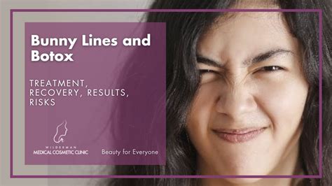 Bunny Lines and Botulinum Toxin | Medspa & Skin Care in Thornhill ...