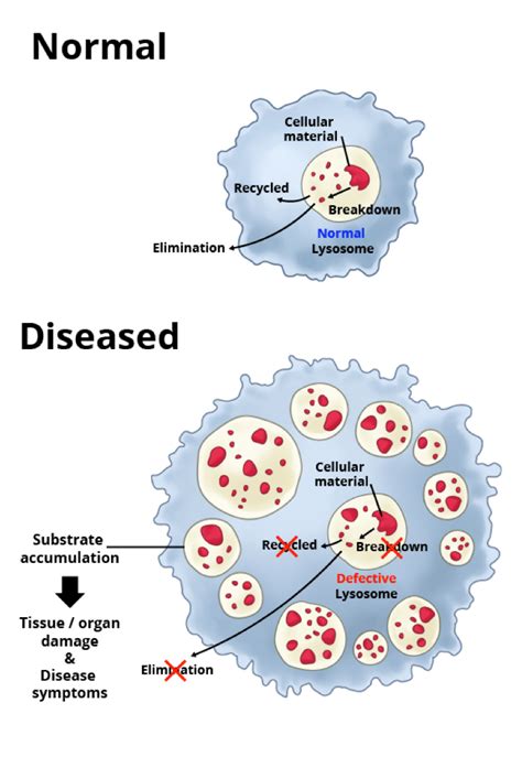 Inherited disorders of subcellular organelles - StudyHits.Com