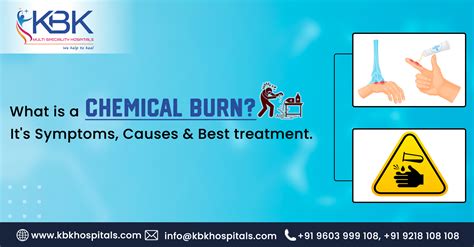 What is a Chemical Burn? Symptoms, Causes & Best Treatment.