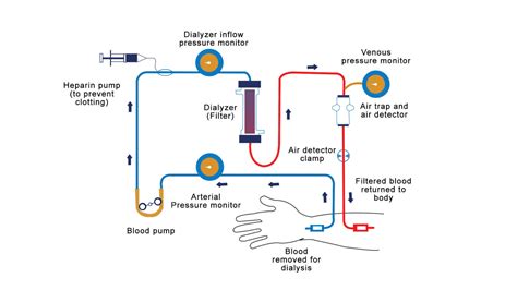 Haemodialysis – NutritionFact.in