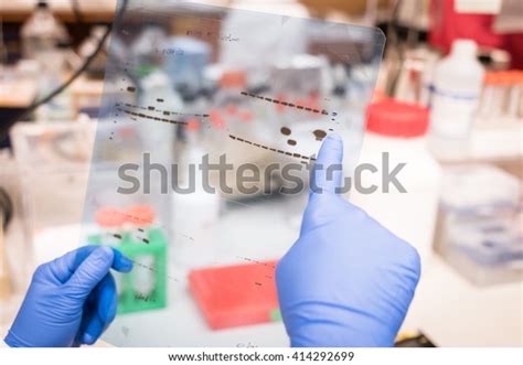 4 Western Blot Gel Picture Images, Stock Photos & Vectors | Shutterstock