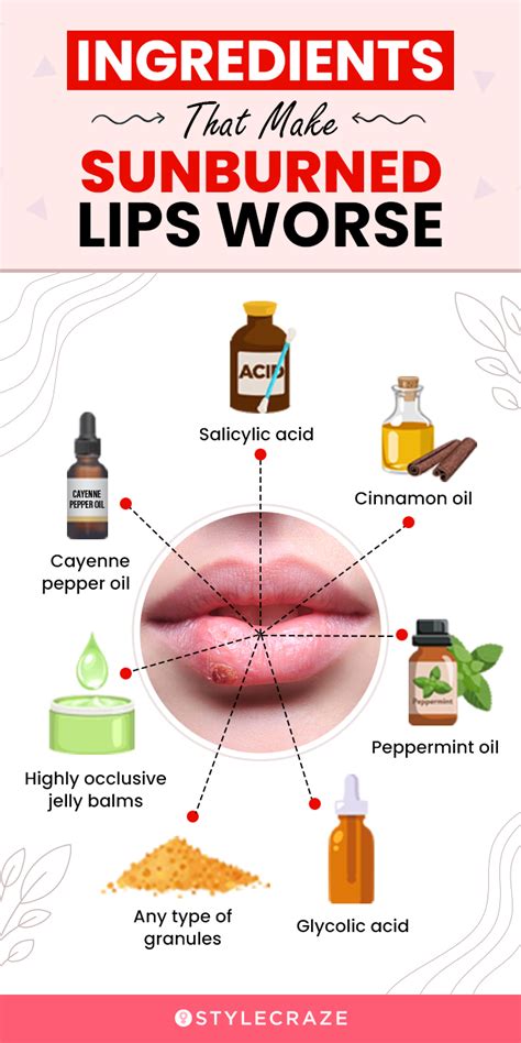 Sunburn On Lips Natural Treatment | Lipstutorial.org