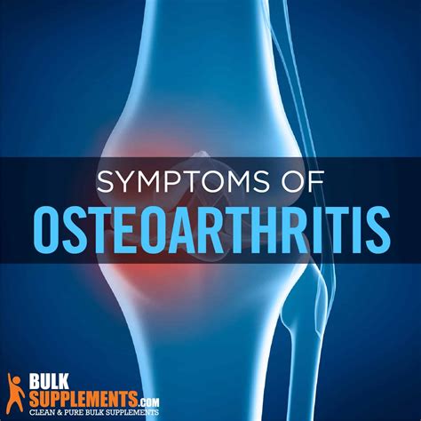 Osteoarthritis Symptoms Causes Treatment - vrogue.co