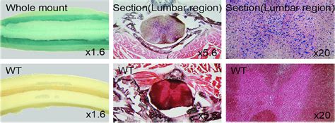 LacZ staining of adult spinal cord. Whole mount staining of 8 week old ...