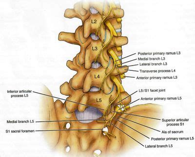 Lumbar Zygapophysial Joint Precision Treatment - WikiMSK