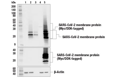 SARS-CoV-2 Membrane Protein (E5A8A) Mouse mAb | Cell Signaling Technology