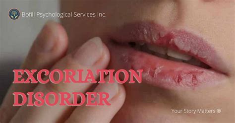 Excoriation Disorder