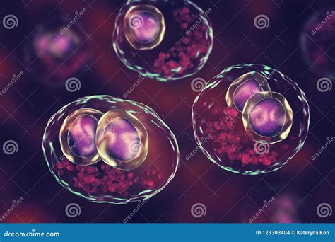 Cytomegalovirus CMV Inside Human Cell, Owl`s Eye Inclusion in the Nucleus, Multinucleated Cell ...