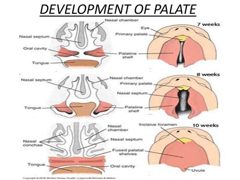 Cleft lip & cleft palate