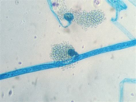 Is the fungi is mucor OR rhizopus? | ResearchGate