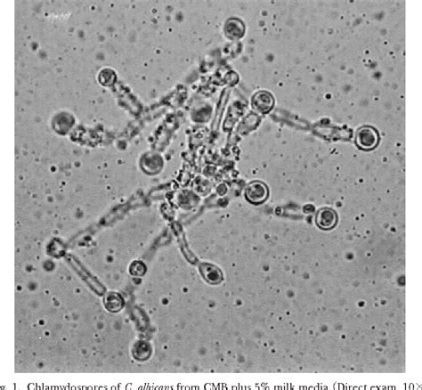 Table 1 from Rapid production of Candida albicans chlamydospores in liquid media under various ...