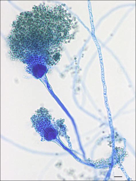 Aspergillus Fumigatus Hyphae