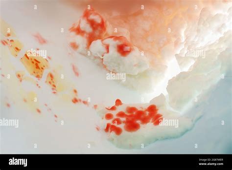 Serratia Marcescens Colony Morphology