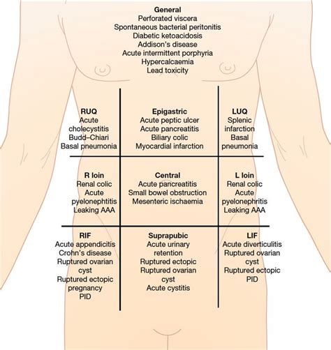 20 best images about acute abdominal pain on Pinterest | Nursing, Assessment and Nursing mnemonics