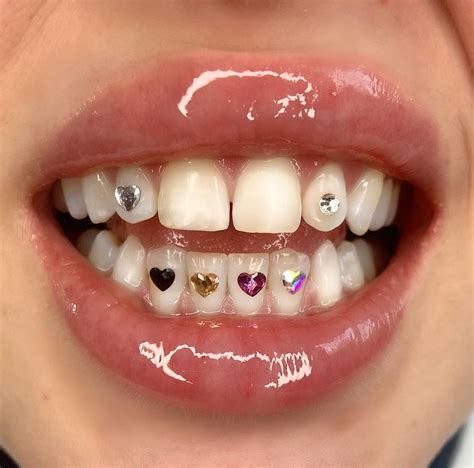 cyberglittter:... | Tooth gem, Teeth jewelry, Diamond teeth