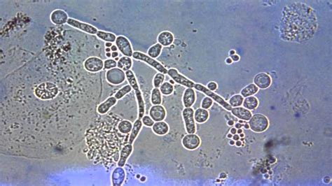 Fungal Pathogens Part 1 of 2 - YouTube