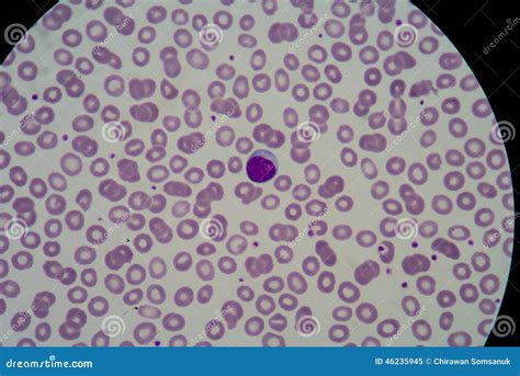 Blood smear stock image. Image of bactericidal, cytoplasm - 46235945