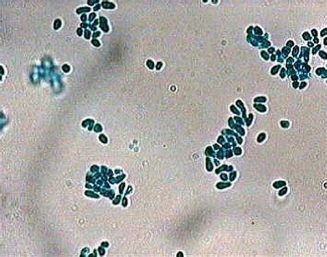 Malassezia Associated With Pachydermatitis Presentation