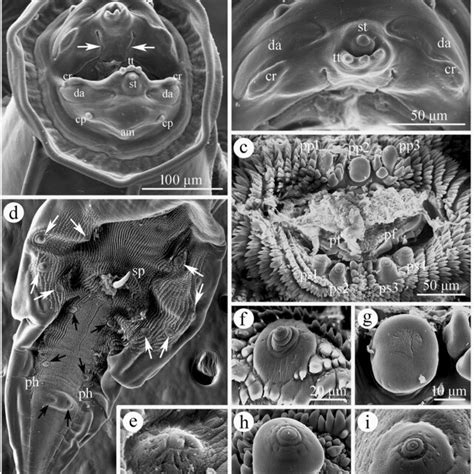 Scanning electron micrographs of Physaloptera sibirica collected from... | Download Scientific ...