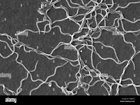 Lyme Disease, Borrelia burgdorferi Bacteria, SEM Stock Photo - Alamy