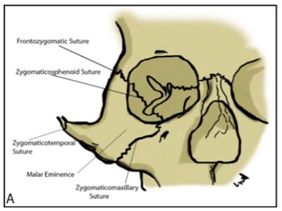 Reduction Anatomy