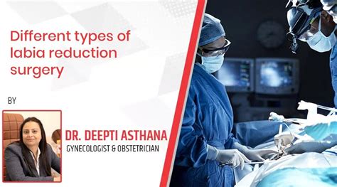 Varieties Of Labial Reduction Surgery | by Dr. Deepti Asthana | Medium