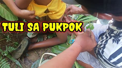 tuli sa pukpok hindi pala masakit - YouTube