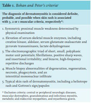 Article: Answer to Photo Quiz: Periorbital oedema and muscle weakness ...